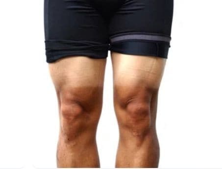 Lotion Your Knees